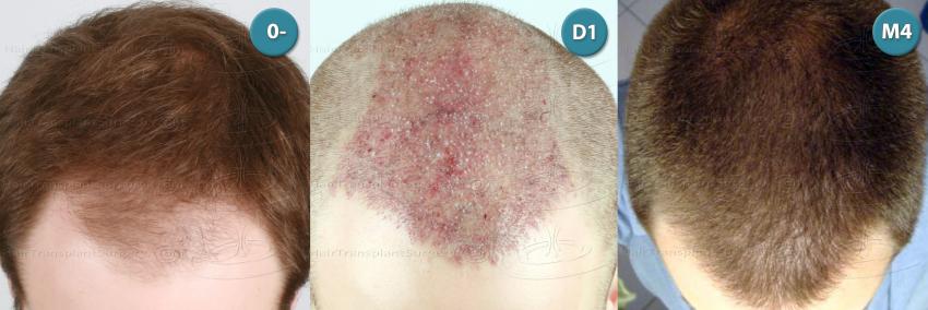 /foren/transplant/index.php?t=getfile&id=39033&private=0