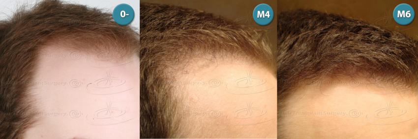 /foren/transplant/index.php?t=getfile&id=39035&private=0