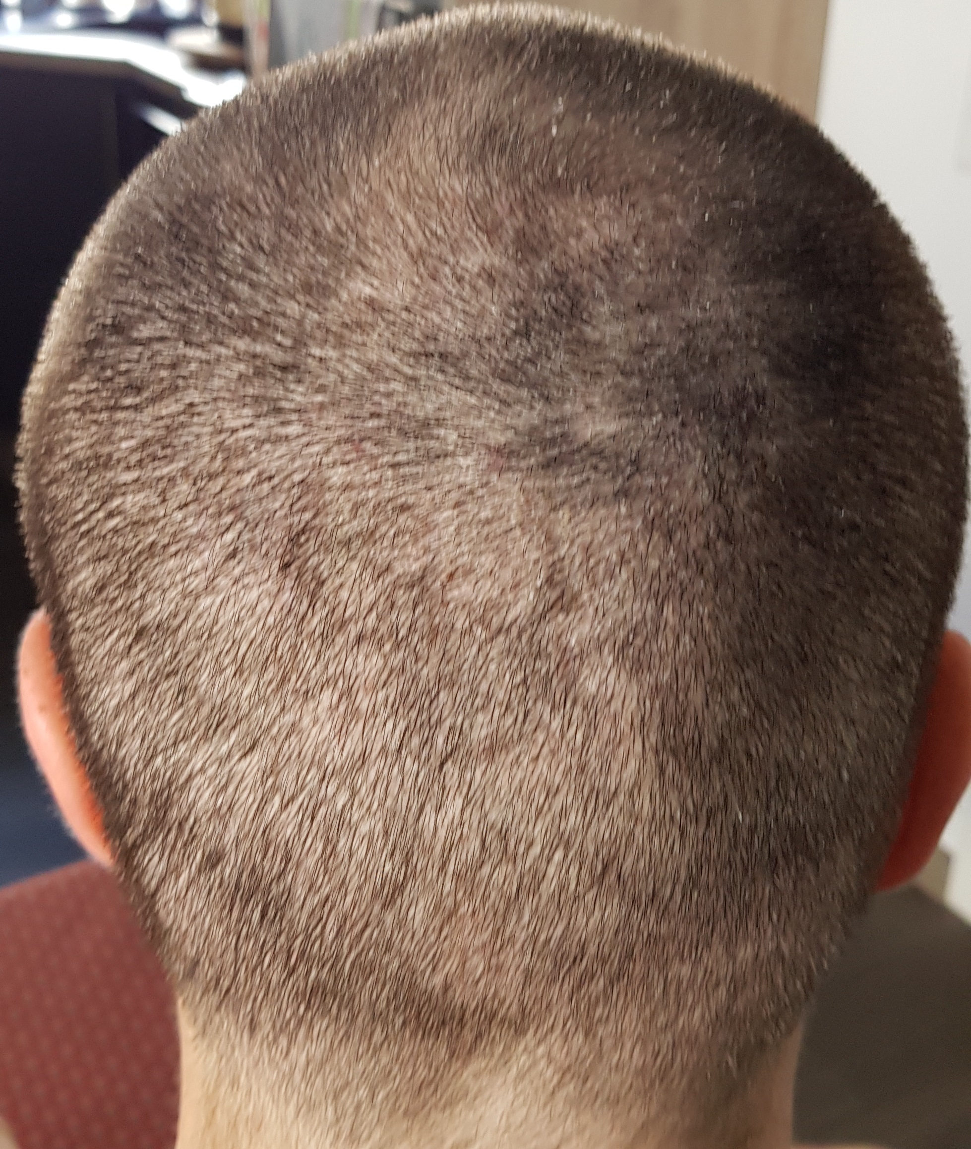 /foren/transplant/index.php?t=getfile&id=39097&private=0