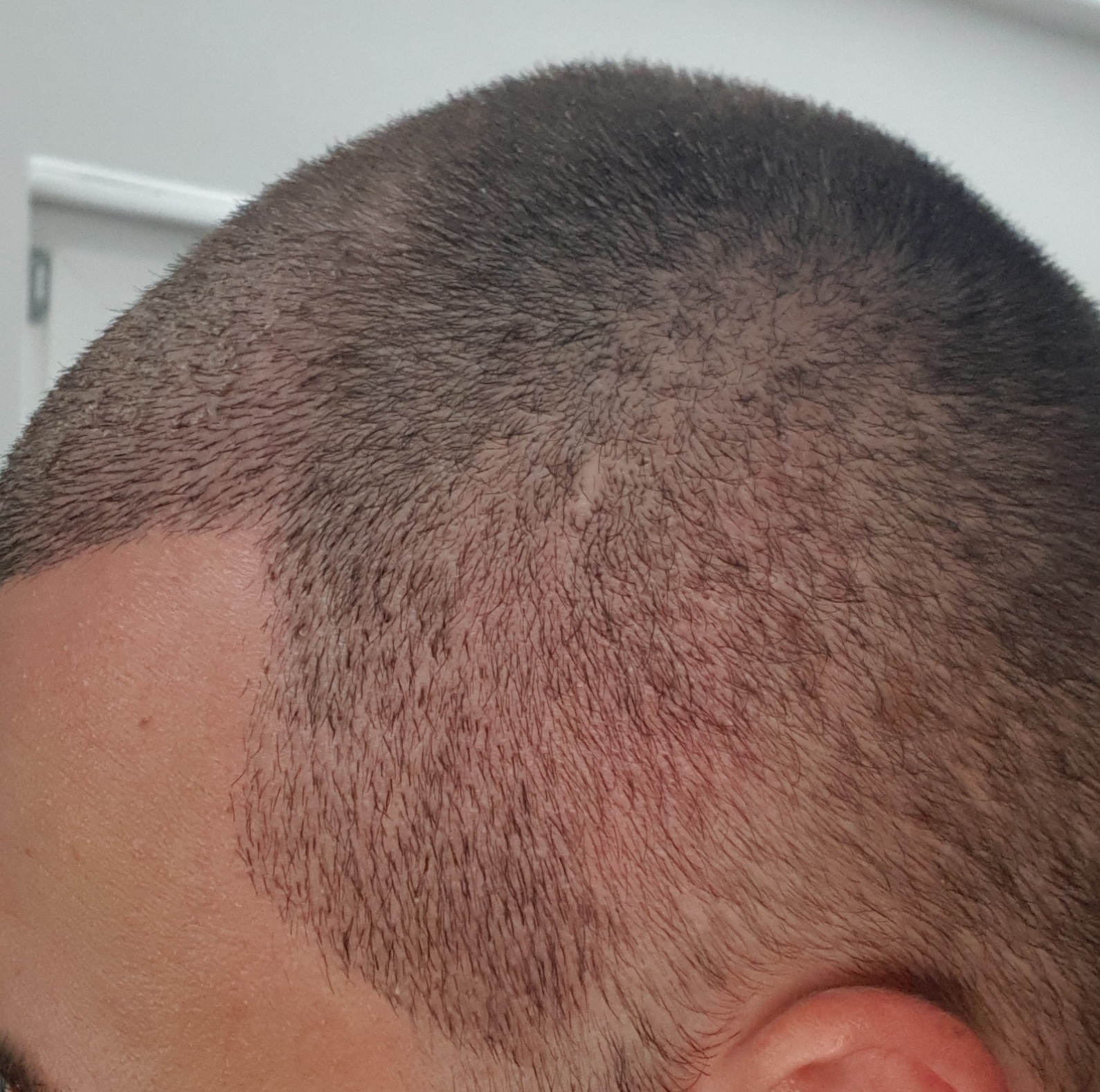 /foren/transplant/index.php?t=getfile&id=39098&private=0