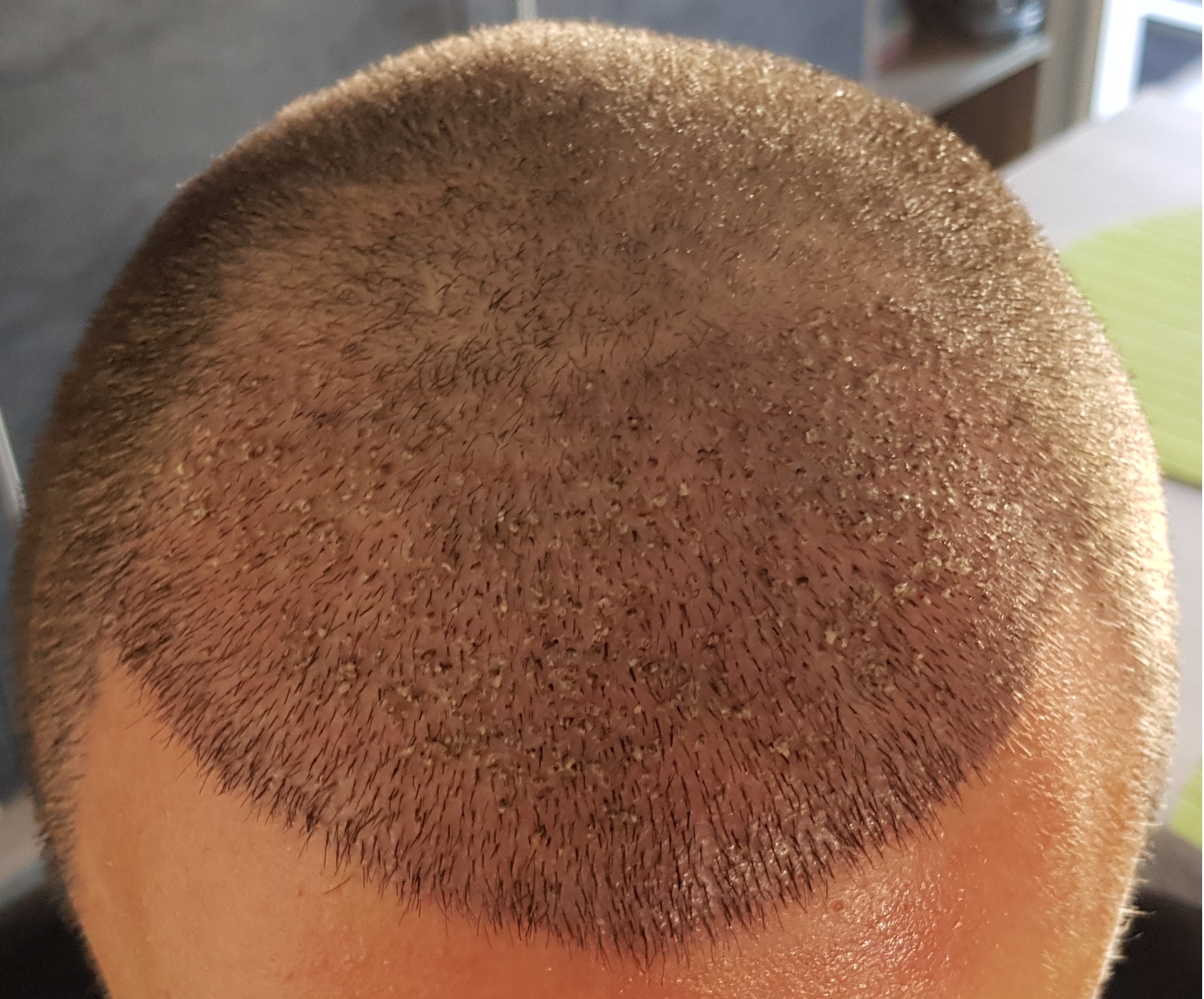 /foren/transplant/index.php?t=getfile&id=39099&private=0