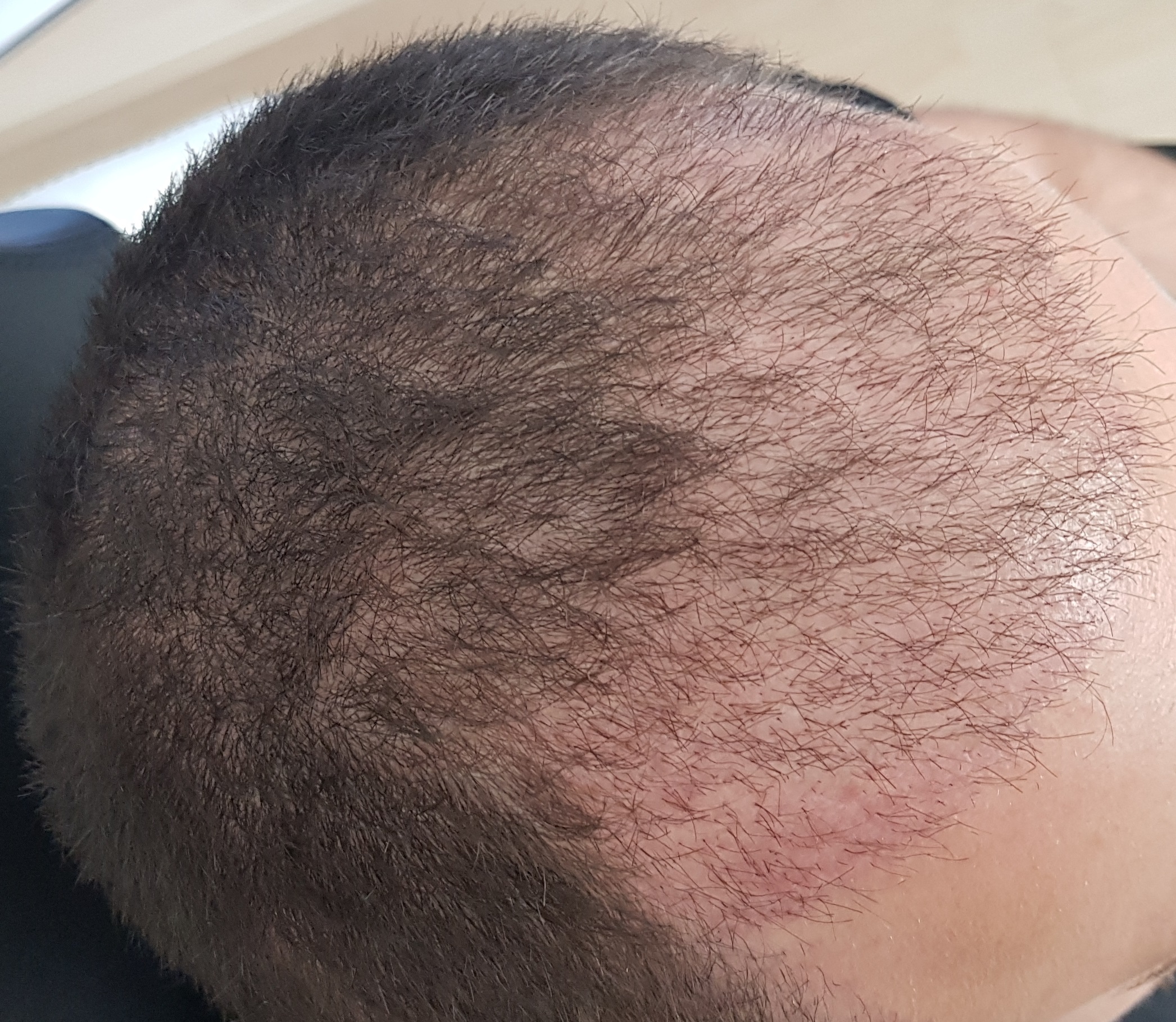 /foren/transplant/index.php?t=getfile&id=39100&private=0