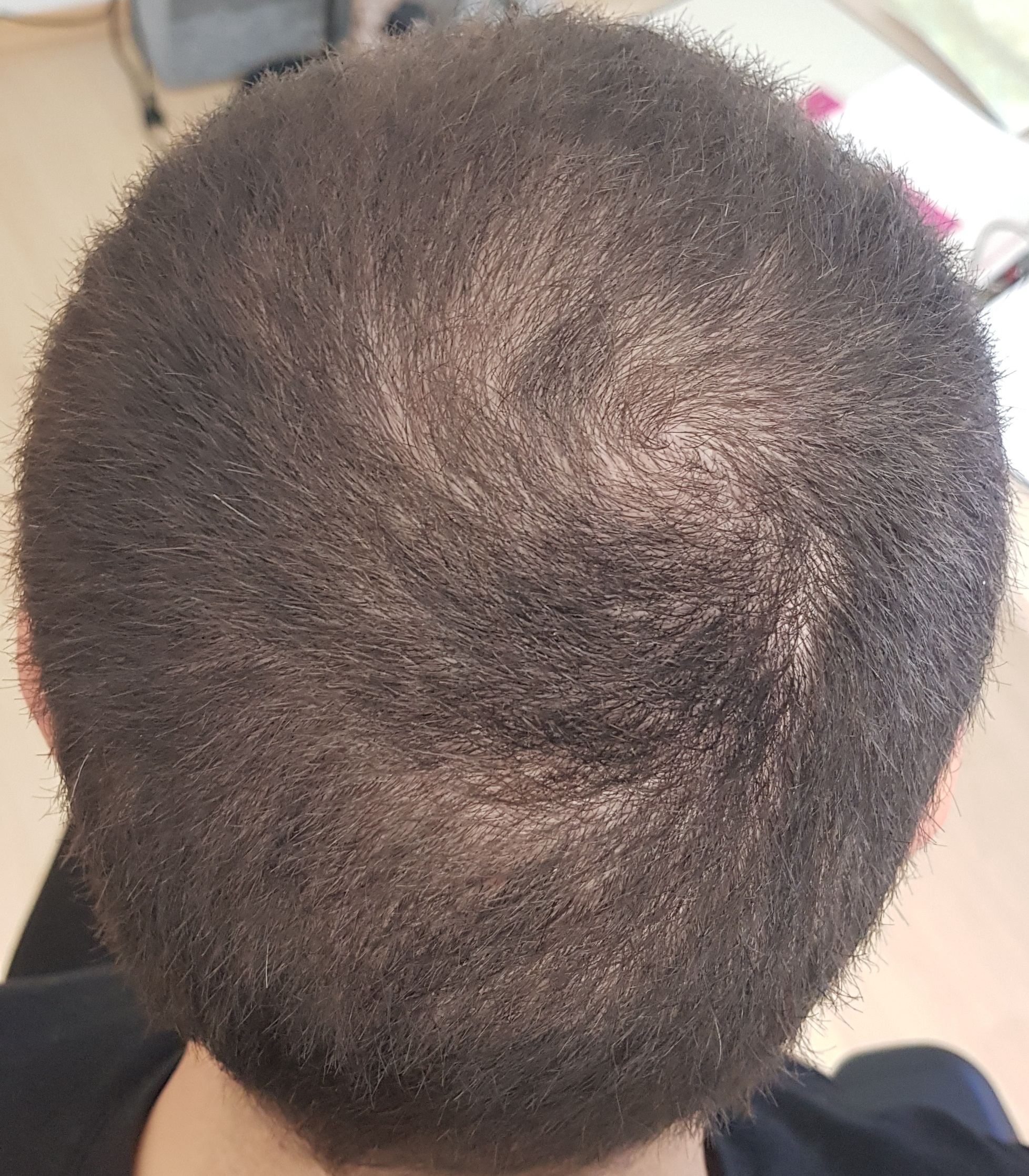 /foren/transplant/index.php?t=getfile&id=39101&private=0