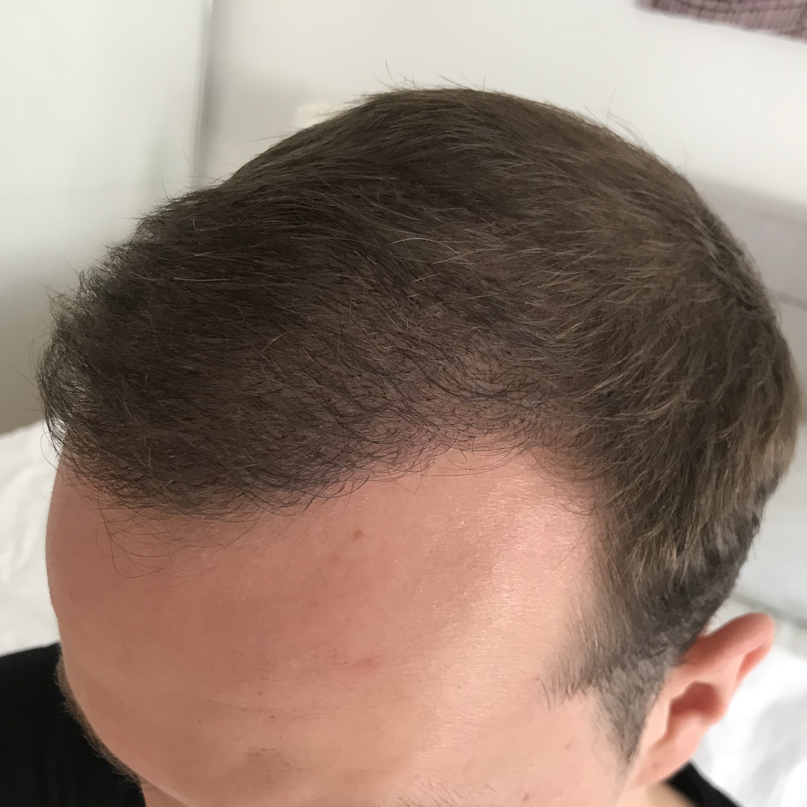 /foren/transplant/index.php?t=getfile&id=39154&private=0