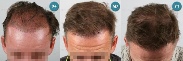 /foren/transplant/index.php?t=getfile&id=39156&private=0