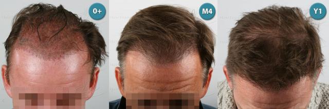 /foren/transplant/index.php?t=getfile&id=39157&private=0