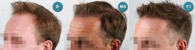 /foren/transplant/index.php?t=getfile&id=39158&private=0