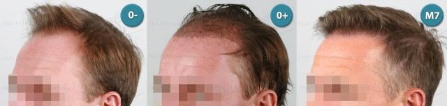 /foren/transplant/index.php?t=getfile&id=39159&private=0