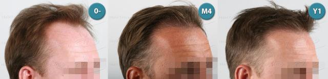 /foren/transplant/index.php?t=getfile&id=39160&private=0