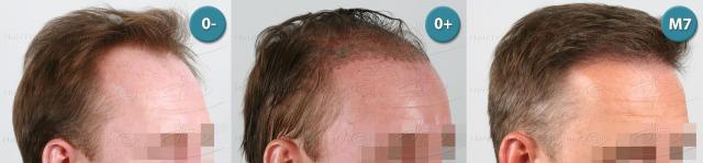 /foren/transplant/index.php?t=getfile&id=39161&private=0