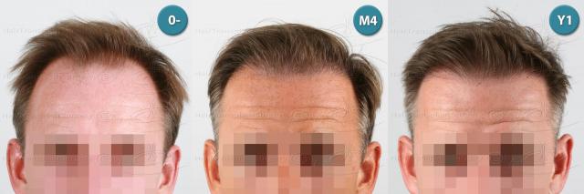 /foren/transplant/index.php?t=getfile&id=39162&private=0