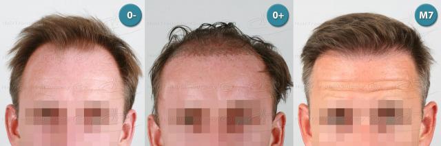 /foren/transplant/index.php?t=getfile&id=39163&private=0