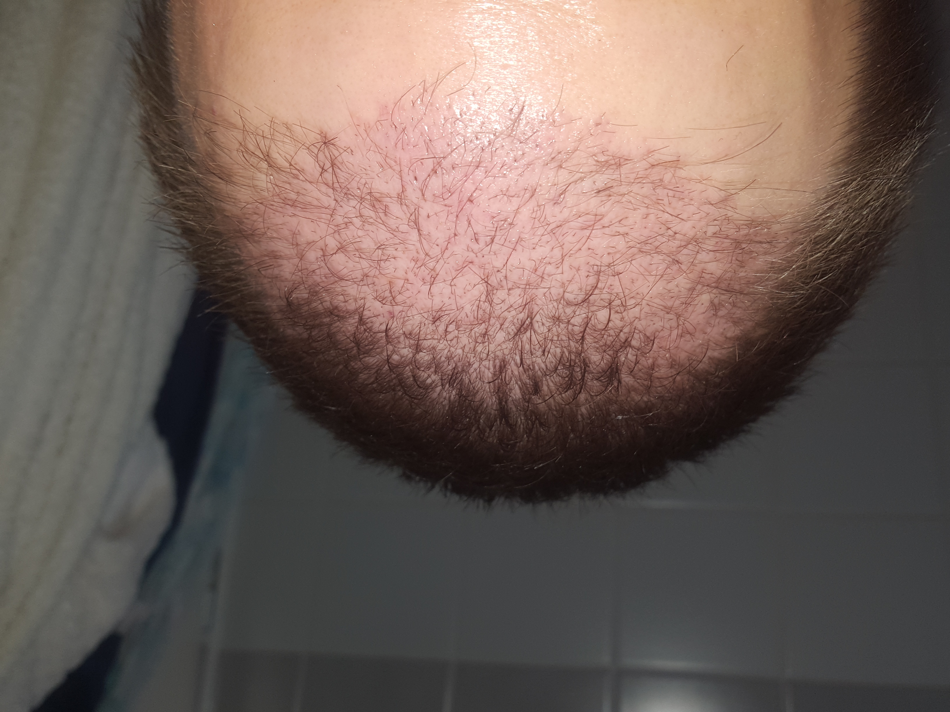 /foren/transplant/index.php?t=getfile&id=39375&private=0