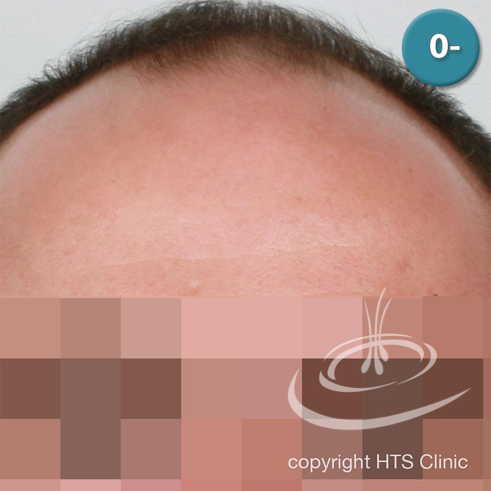 /foren/transplant/index.php?t=getfile&id=39404&private=0