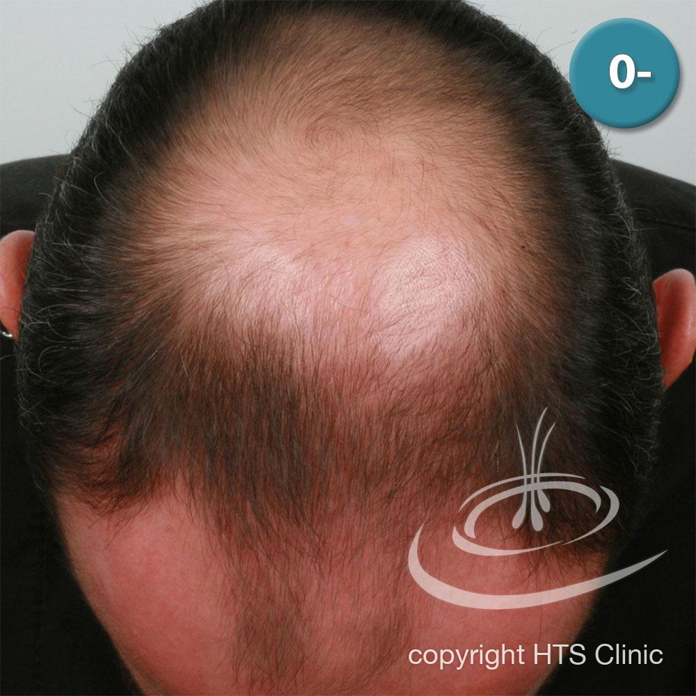 /foren/transplant/index.php?t=getfile&id=39405&private=0