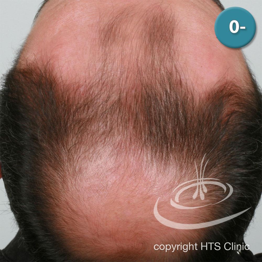 /foren/transplant/index.php?t=getfile&id=39406&private=0