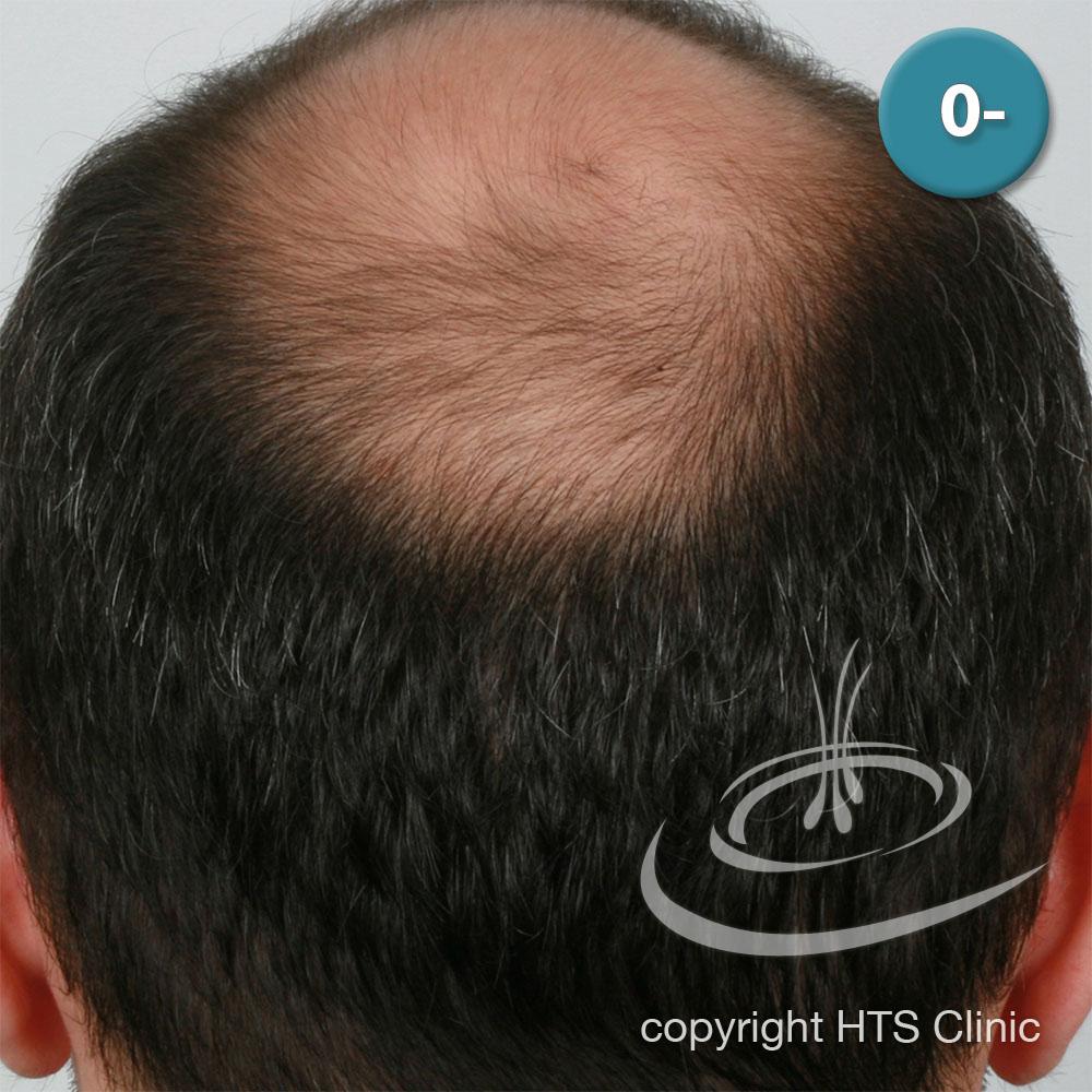 /foren/transplant/index.php?t=getfile&id=39407&private=0