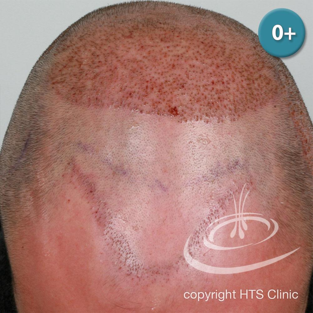 /foren/transplant/index.php?t=getfile&id=39408&private=0