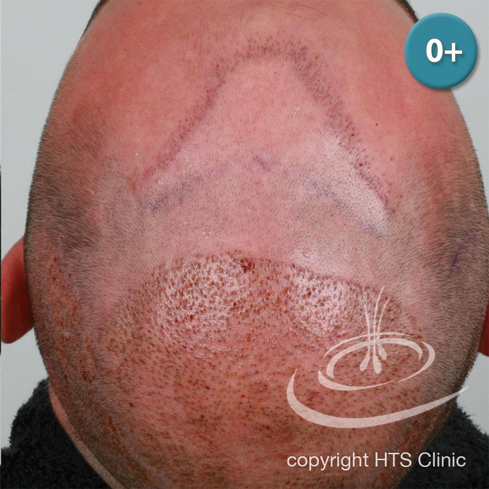 /foren/transplant/index.php?t=getfile&id=39409&private=0