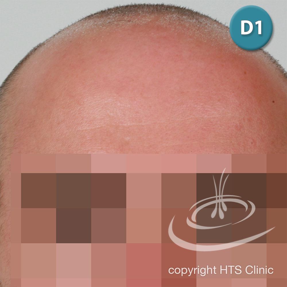 /foren/transplant/index.php?t=getfile&id=39410&private=0