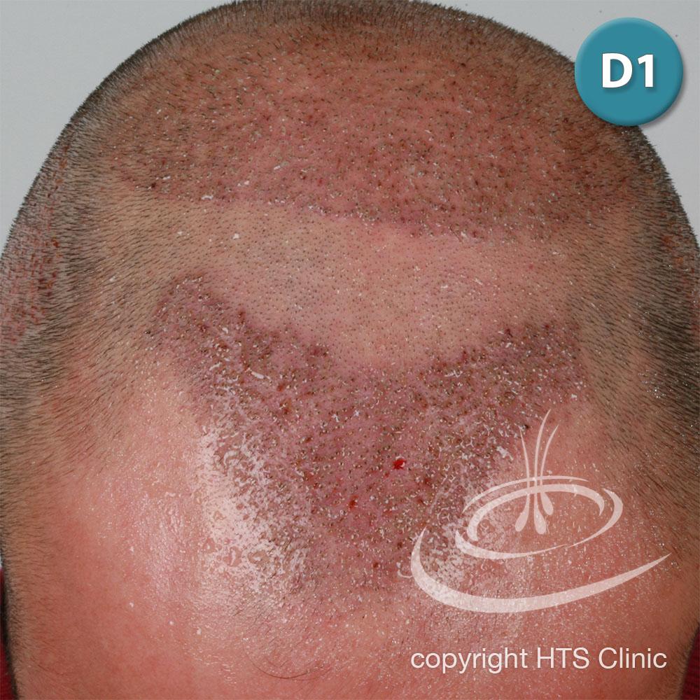 /foren/transplant/index.php?t=getfile&id=39411&private=0