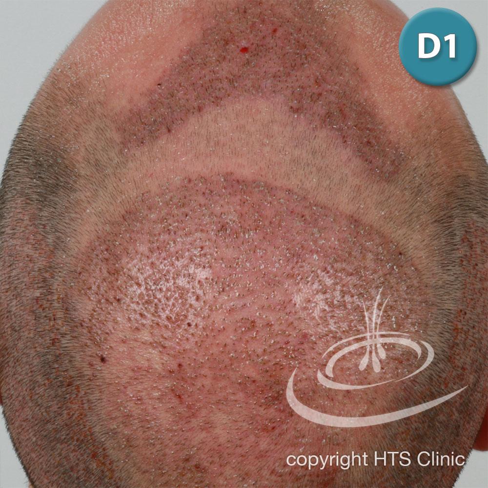 /foren/transplant/index.php?t=getfile&id=39412&private=0