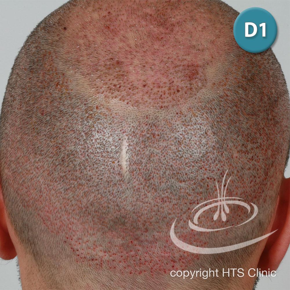 /foren/transplant/index.php?t=getfile&id=39413&private=0