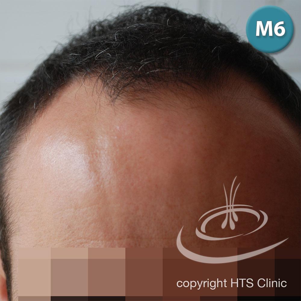 /foren/transplant/index.php?t=getfile&id=39414&private=0