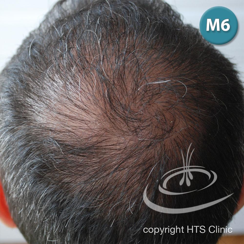 /foren/transplant/index.php?t=getfile&id=39415&private=0