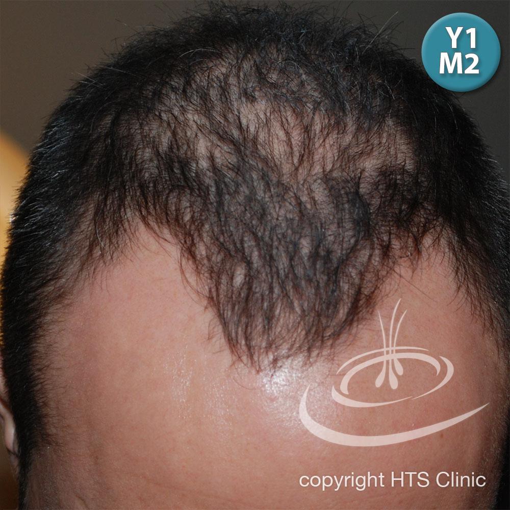 /foren/transplant/index.php?t=getfile&id=39417&private=0