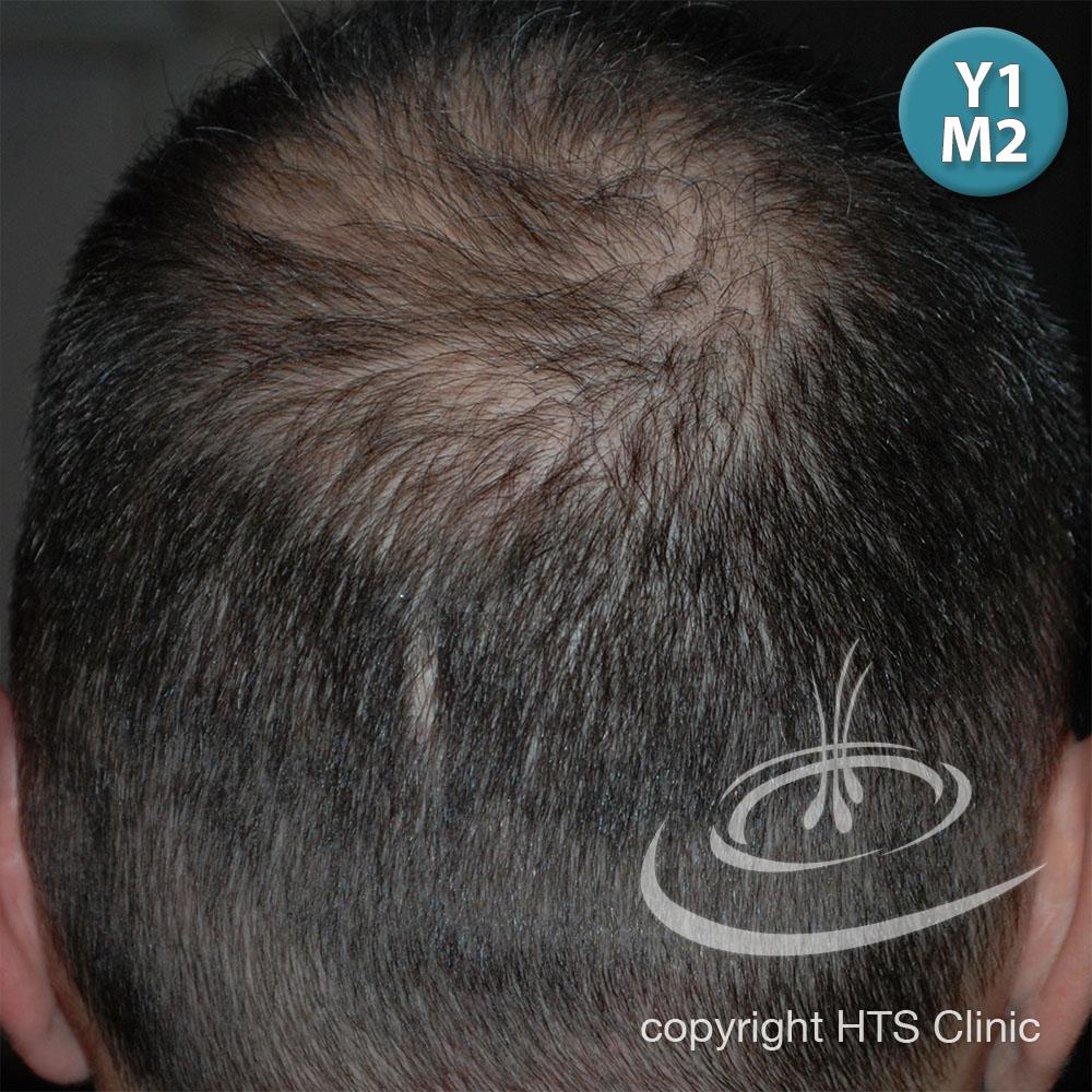 /foren/transplant/index.php?t=getfile&id=39418&private=0