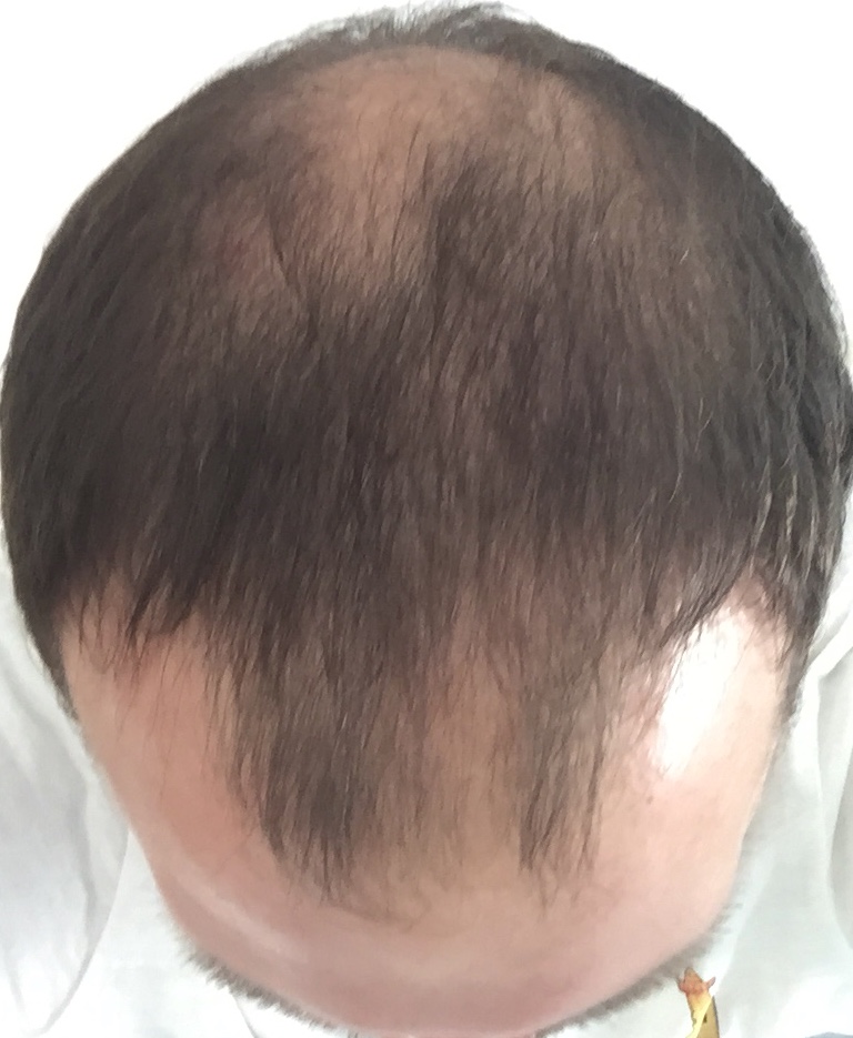 /foren/transplant/index.php?t=getfile&id=39456&private=0