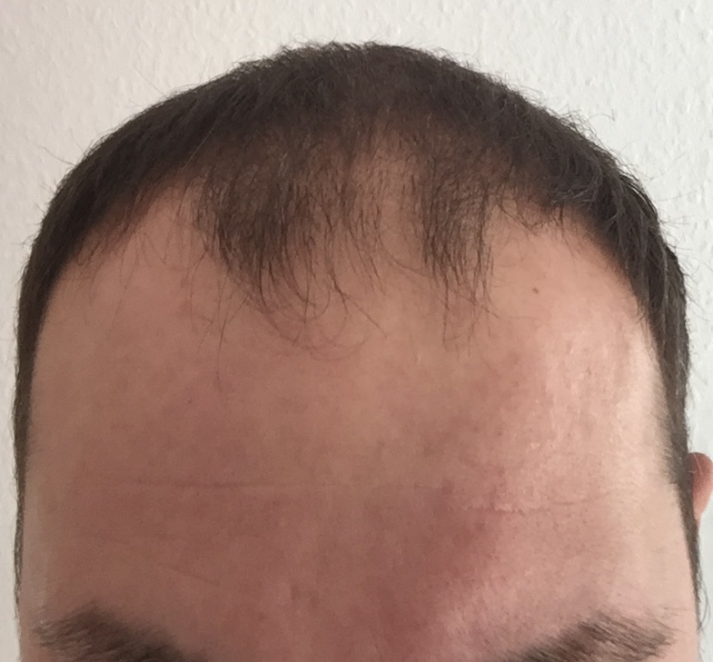 /foren/transplant/index.php?t=getfile&id=39458&private=0