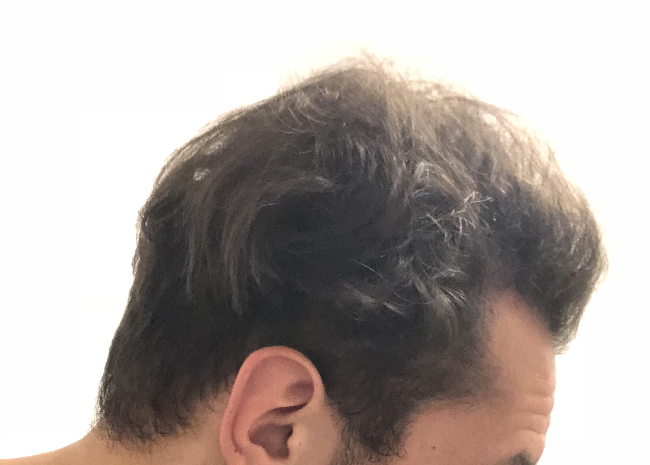 /foren/transplant/index.php?t=getfile&id=39573&private=0