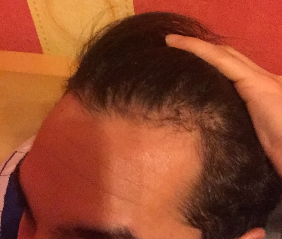 /foren/transplant/index.php?t=getfile&id=39576&private=0