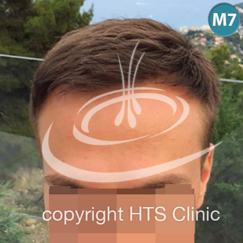 /foren/transplant/index.php?t=getfile&id=39612&private=0