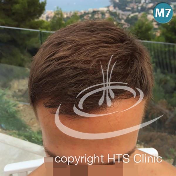 /foren/transplant/index.php?t=getfile&id=39613&private=0