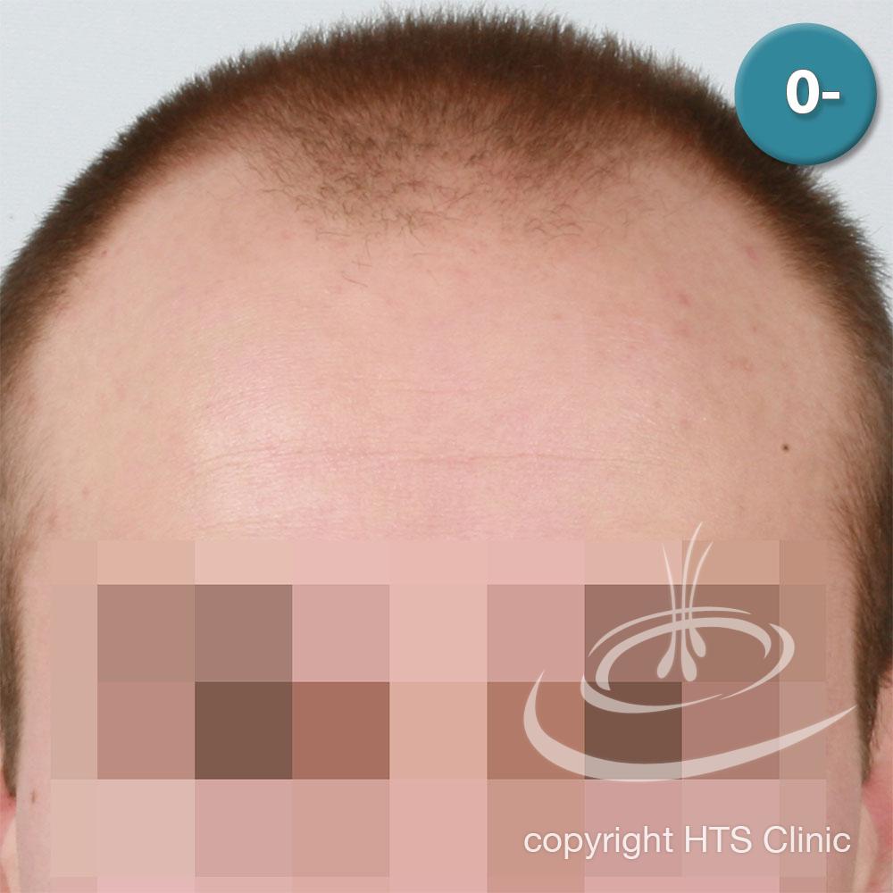 /foren/transplant/index.php?t=getfile&id=39614&private=0