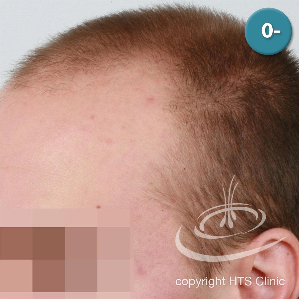 /foren/transplant/index.php?t=getfile&id=39615&private=0