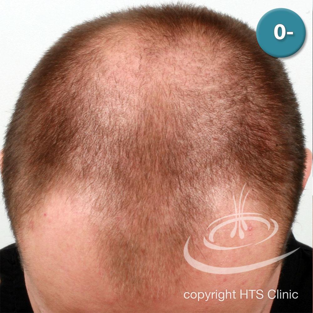 /foren/transplant/index.php?t=getfile&id=39616&private=0