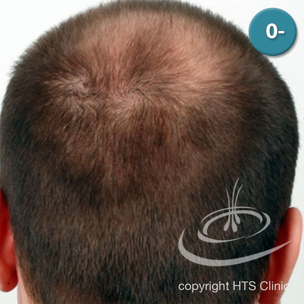 /foren/transplant/index.php?t=getfile&id=39617&private=0