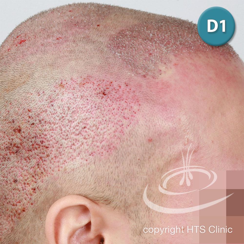 /foren/transplant/index.php?t=getfile&id=39619&private=0