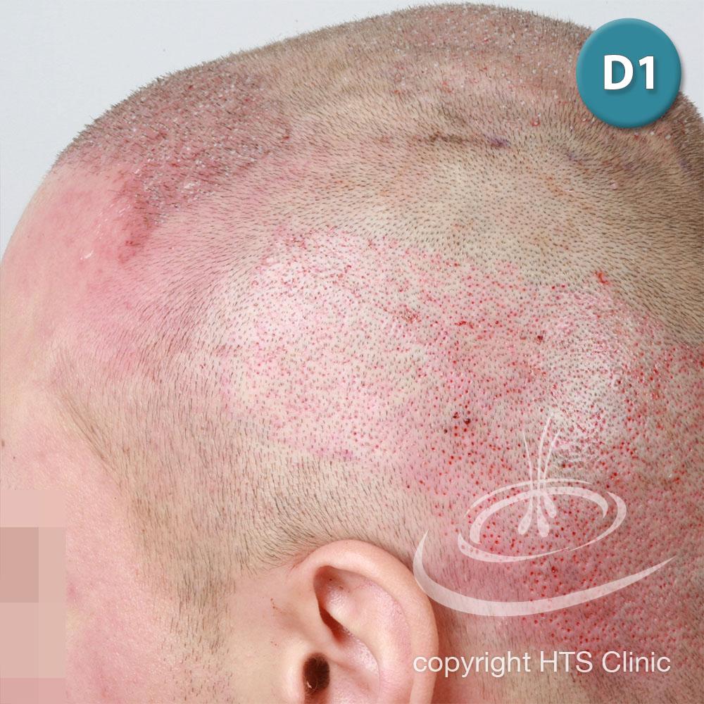 /foren/transplant/index.php?t=getfile&id=39620&private=0