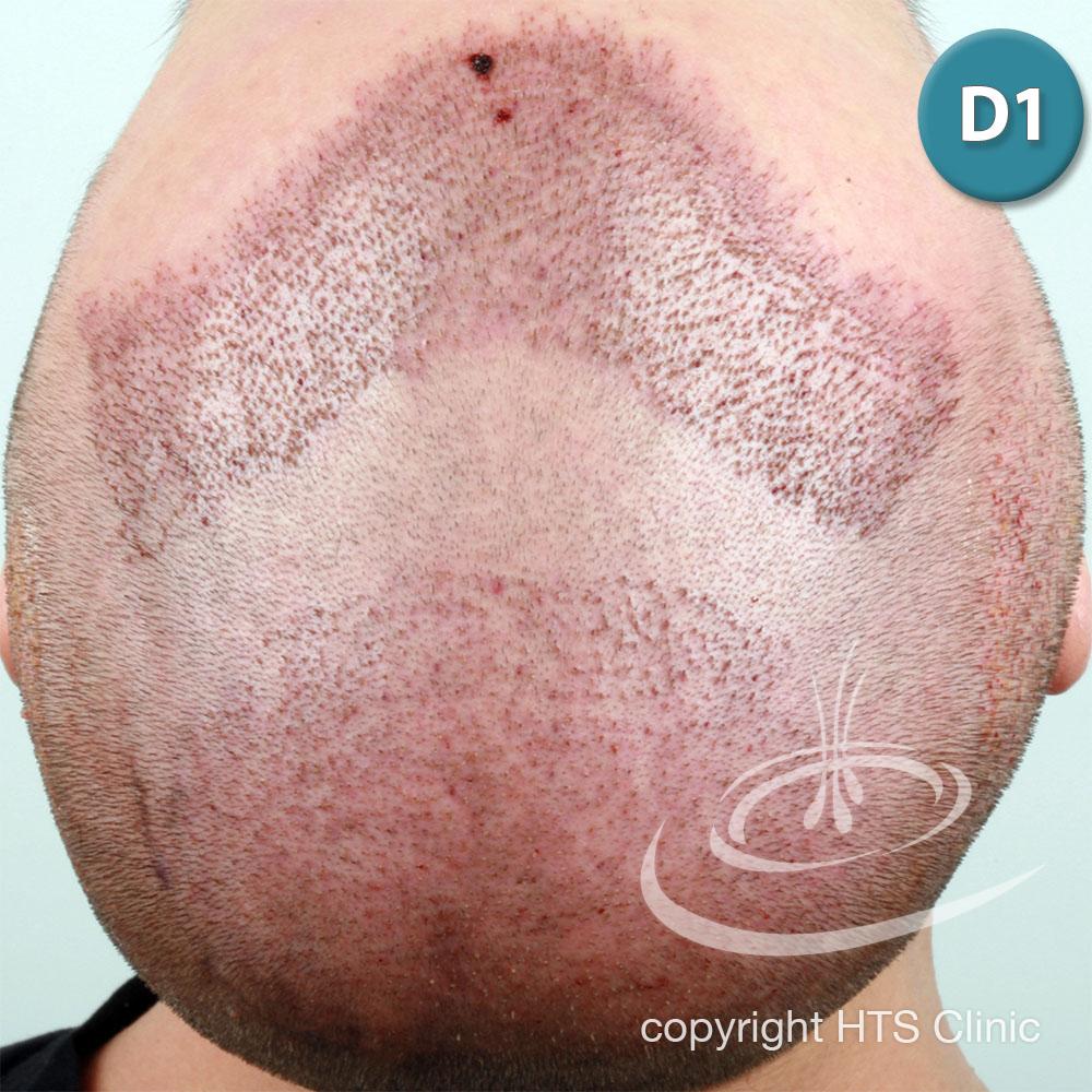 /foren/transplant/index.php?t=getfile&id=39621&private=0