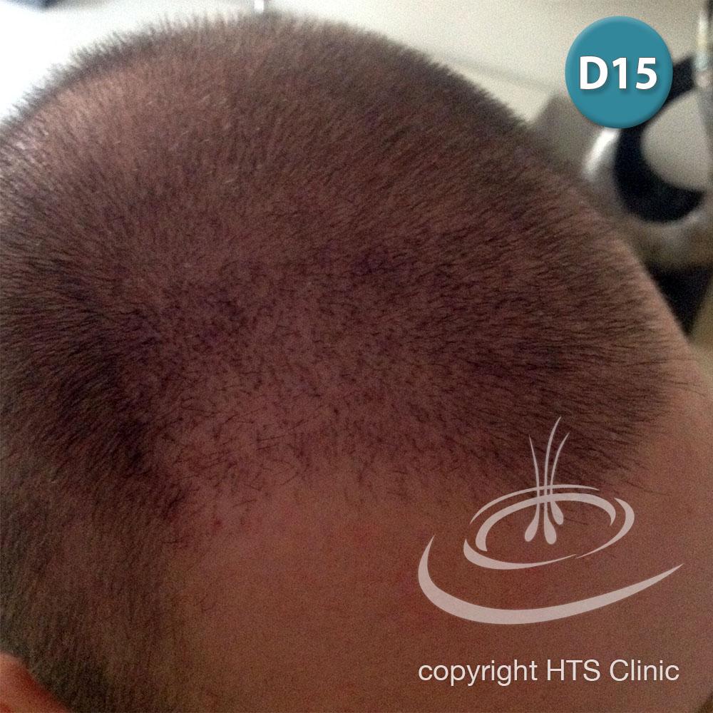 /foren/transplant/index.php?t=getfile&id=39622&private=0