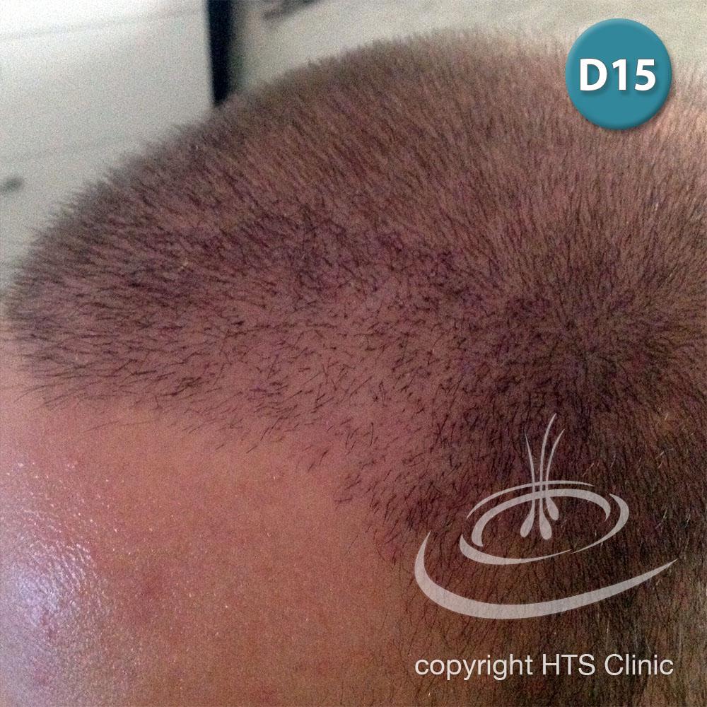 /foren/transplant/index.php?t=getfile&id=39623&private=0