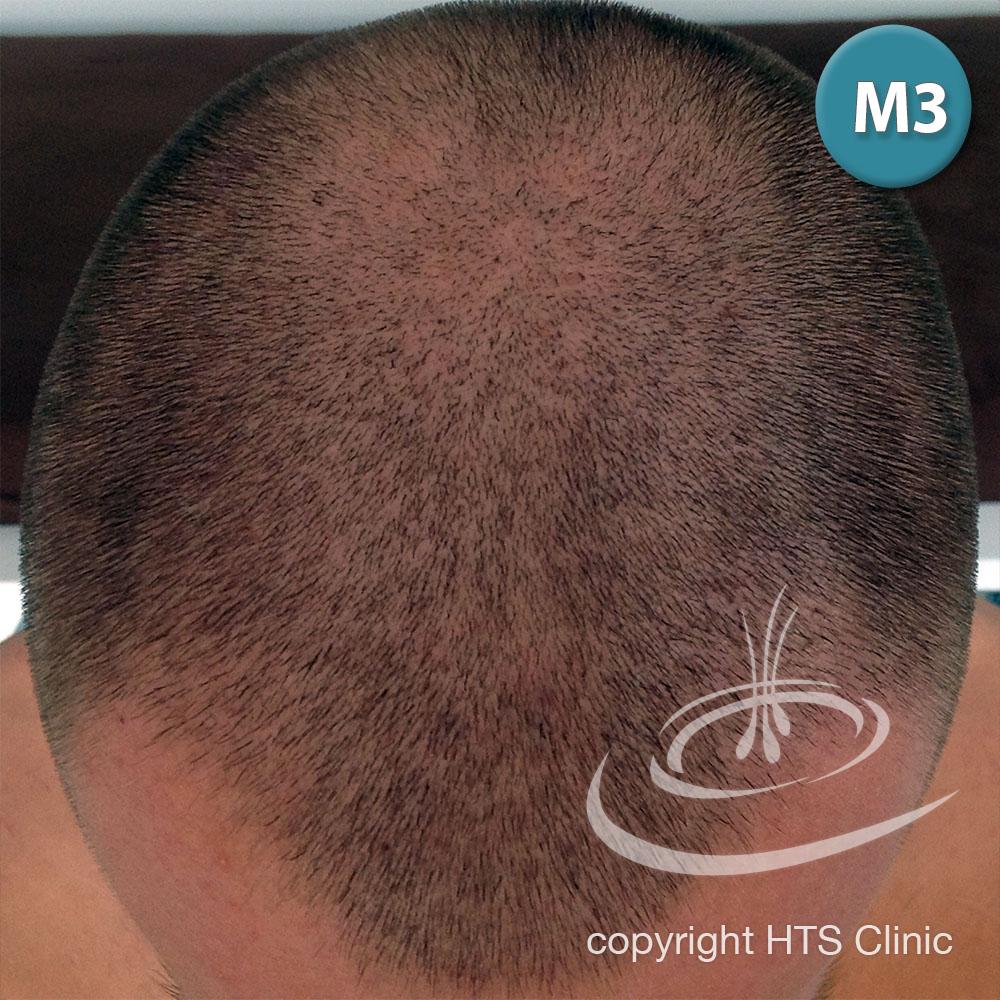 /foren/transplant/index.php?t=getfile&id=39624&private=0