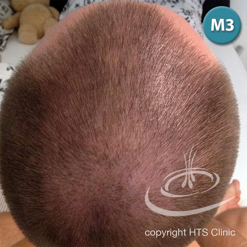 /foren/transplant/index.php?t=getfile&id=39625&private=0