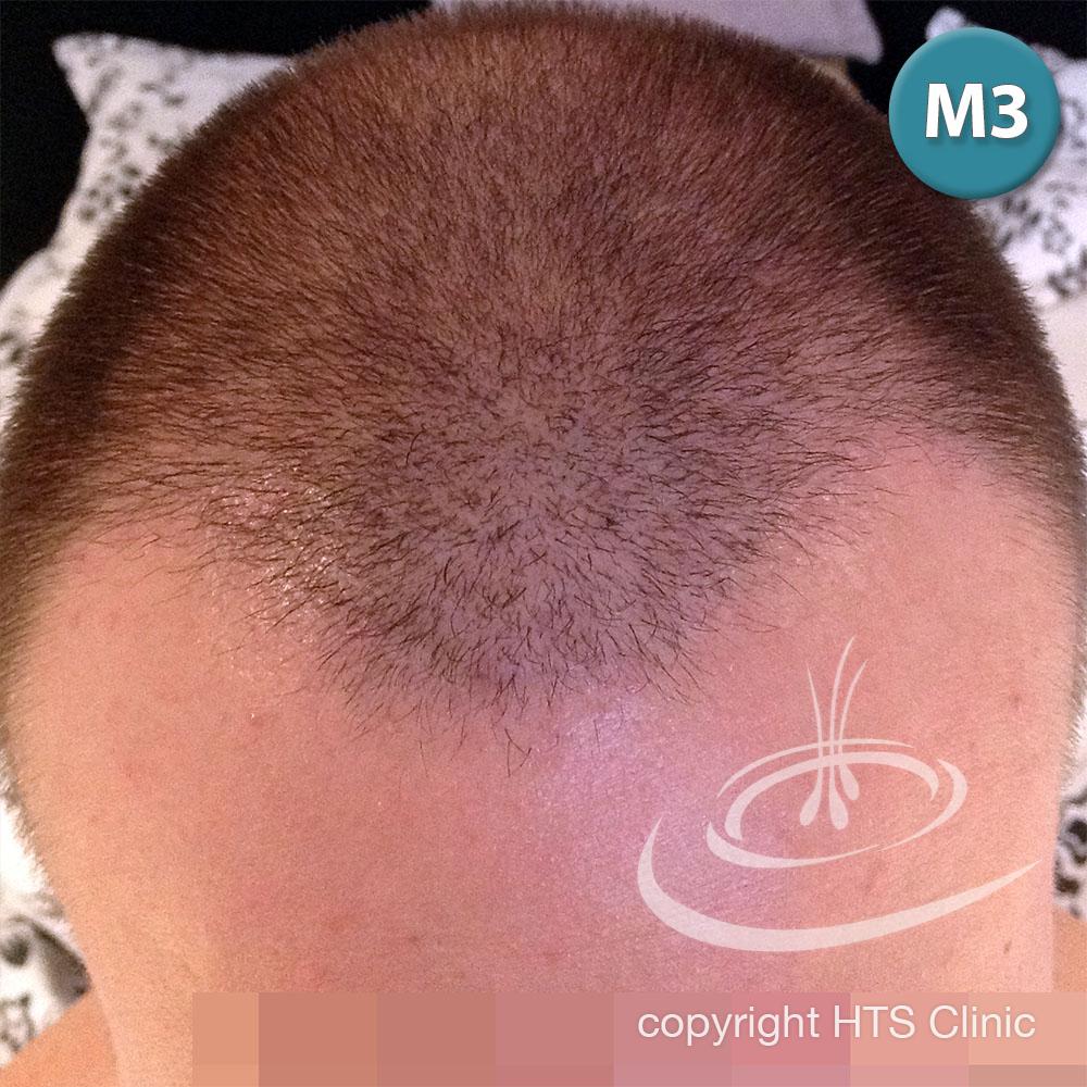 /foren/transplant/index.php?t=getfile&id=39626&private=0