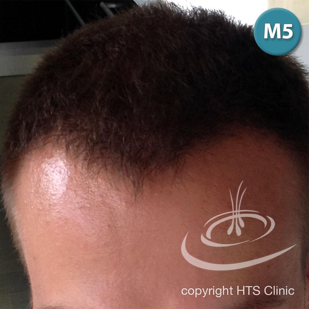 /foren/transplant/index.php?t=getfile&id=39627&private=0